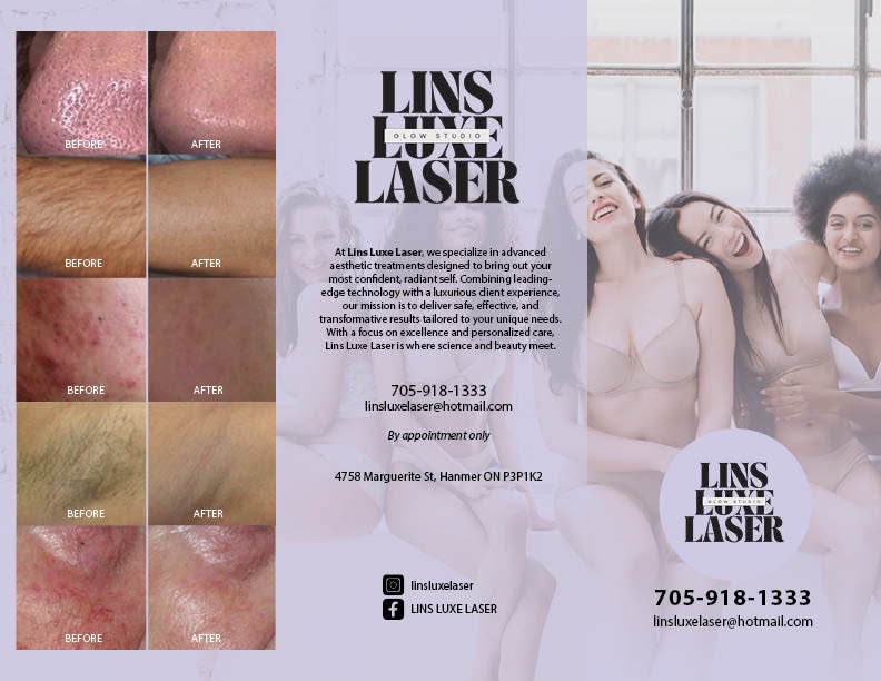 Lins Luxe Laser before and after treatment results