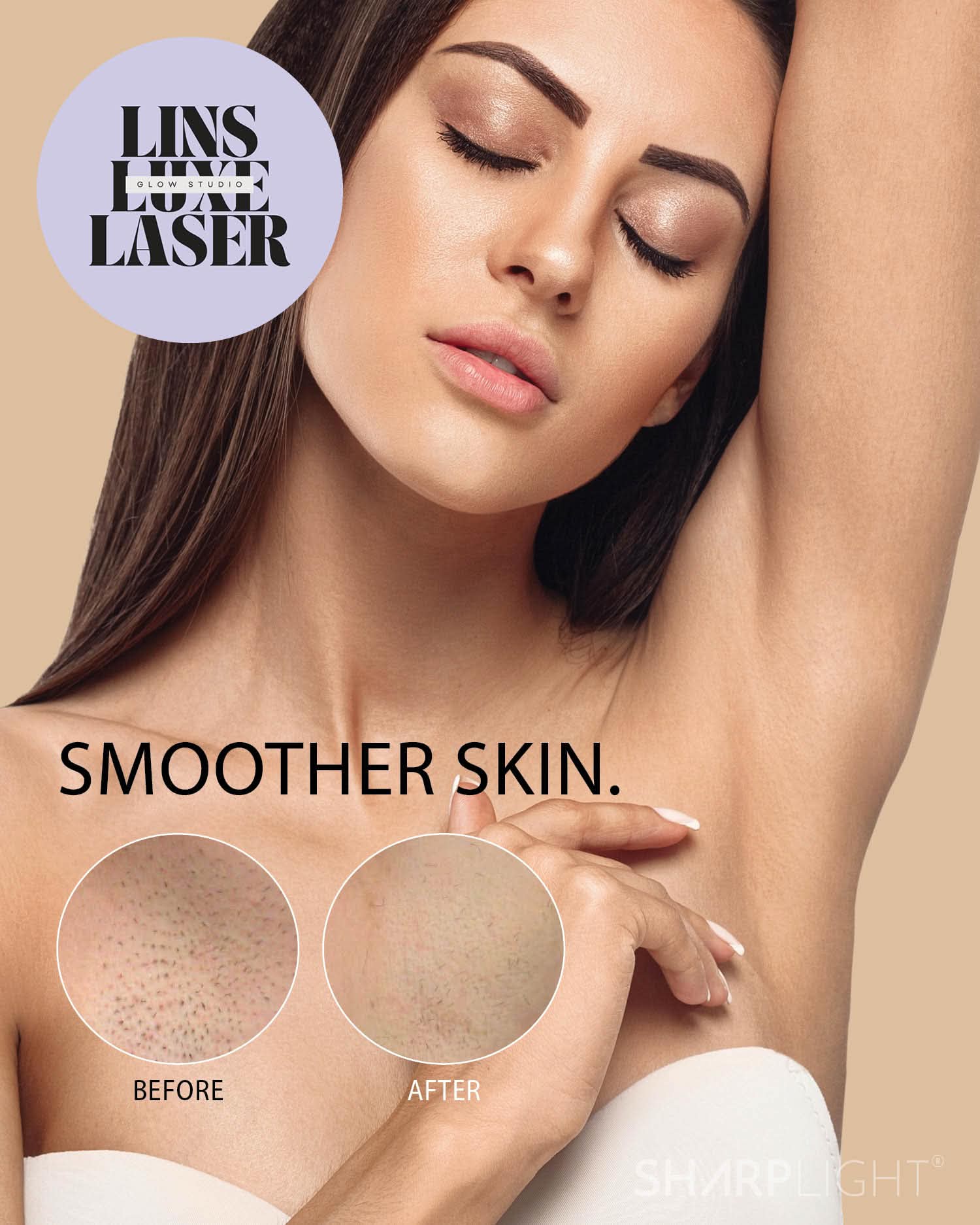 Smoother skin results from laser hair removal